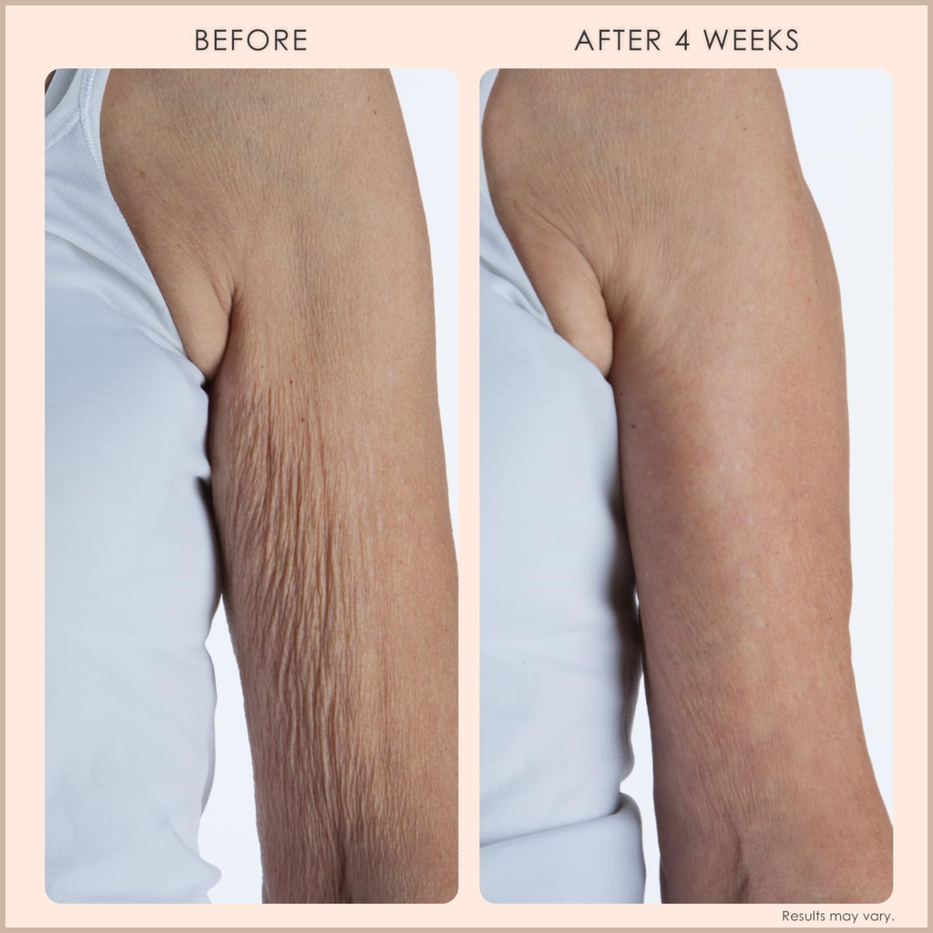 Firming Body Cream for Crepey Skin – Collagen Peptides & TruFirm Technology Moisturizer